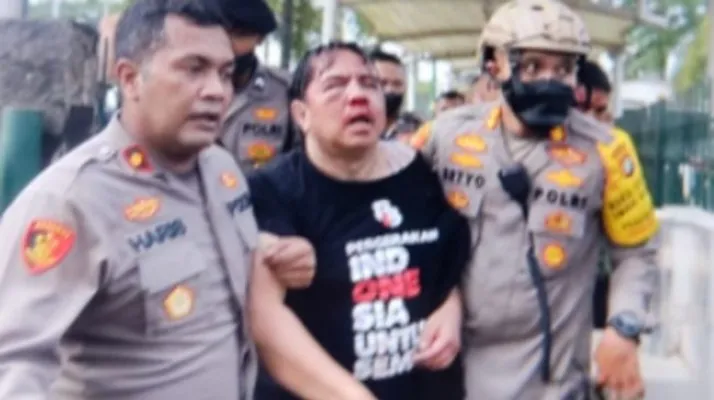 Pegiat media sosial Ade Armando menjadi korban diduga oknum provokator di depan Gedung DPR RI. (ist)