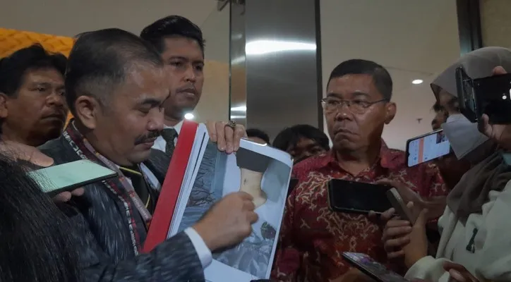 Kamaruddin Simanjuntak bersama tim kuasa hukum keluarga menemukan banyak kejanggalan pada bekas luka di jenzaha Brigadir J. (foto: poskota/zendy)