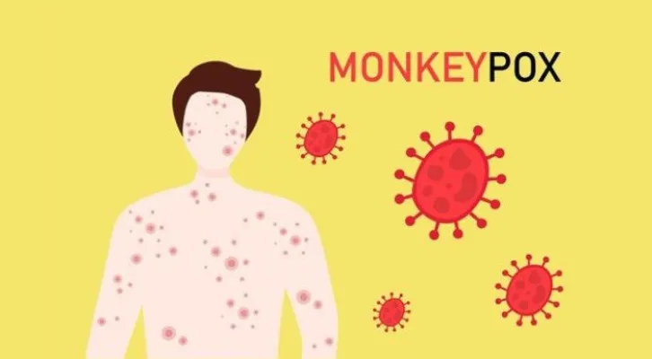 Mengenal apa itu monkeypox atau yang dikenal cacar monyet, ketahui penyebaran, tanda dan gejalanya. (Foto: Pinterest/Vecteezy)