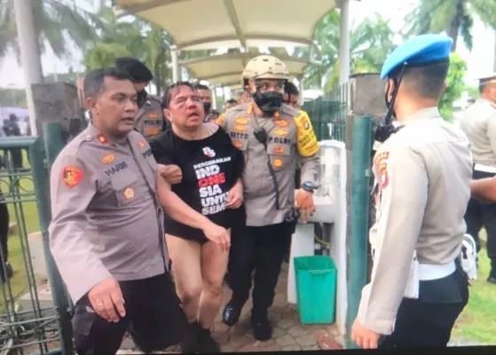 Ade Armando tampak babak belur usai dihajar oknum pengunjuk rasa. (foto: ist).