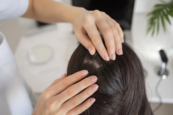 Hindari rambut rontok dengan menggunakan bawang putih juga ternyata efektif loh. . (Foto: Freepik)