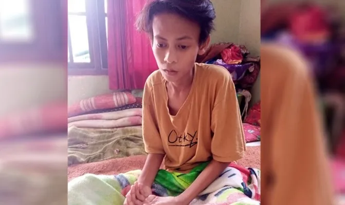 Alami KIPI usai divaksin Covid-19, begini kondisi Yopa pelajar asal Pandeglang. (Foto/dokprobadi)