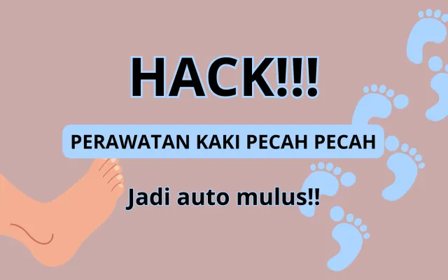 Gunakan cara ini untuk mengatasi kaki pecah-pecah. (Poskota/Syifa Luthfiyah)